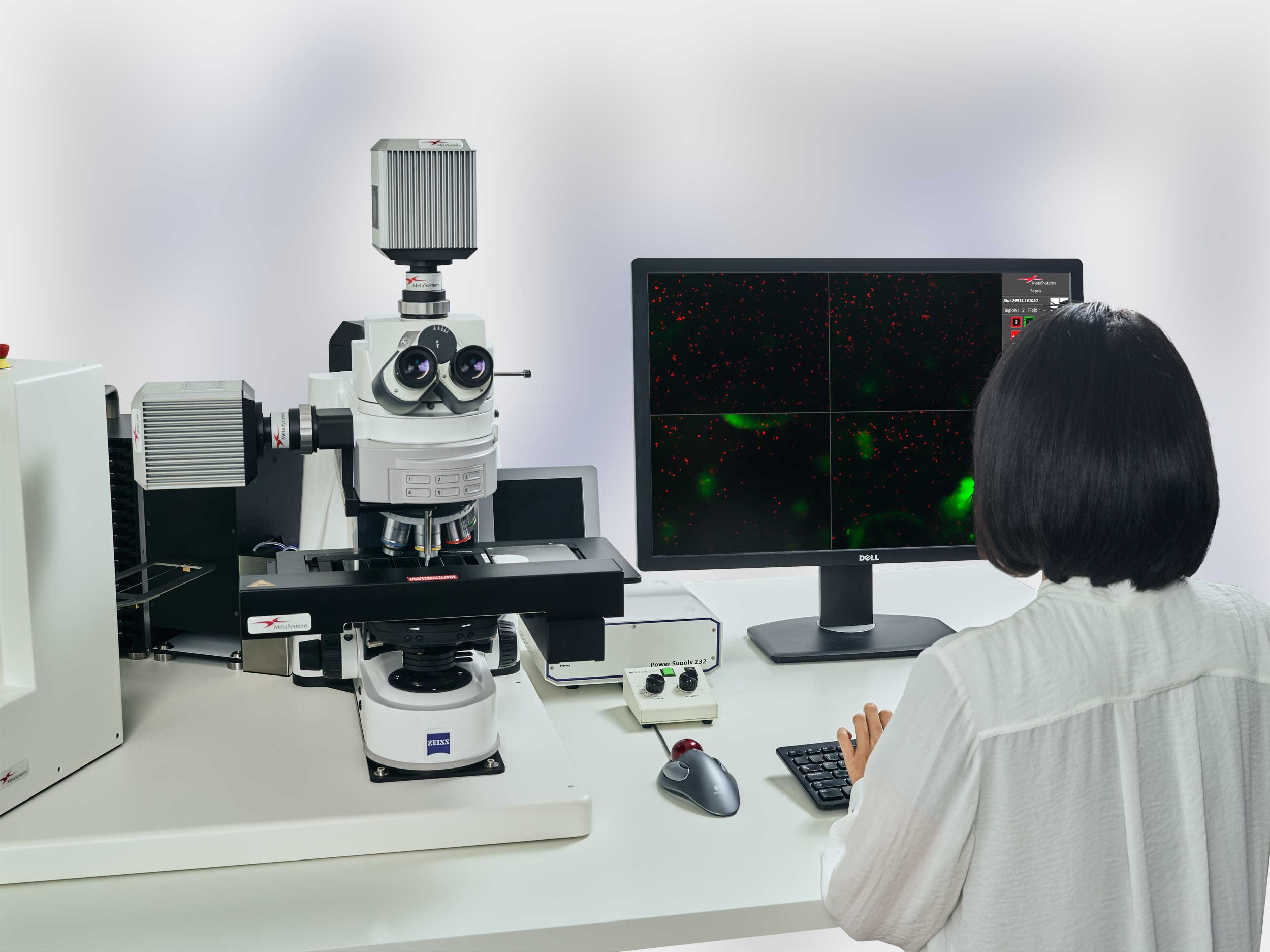 Metafer automated scanning platform
